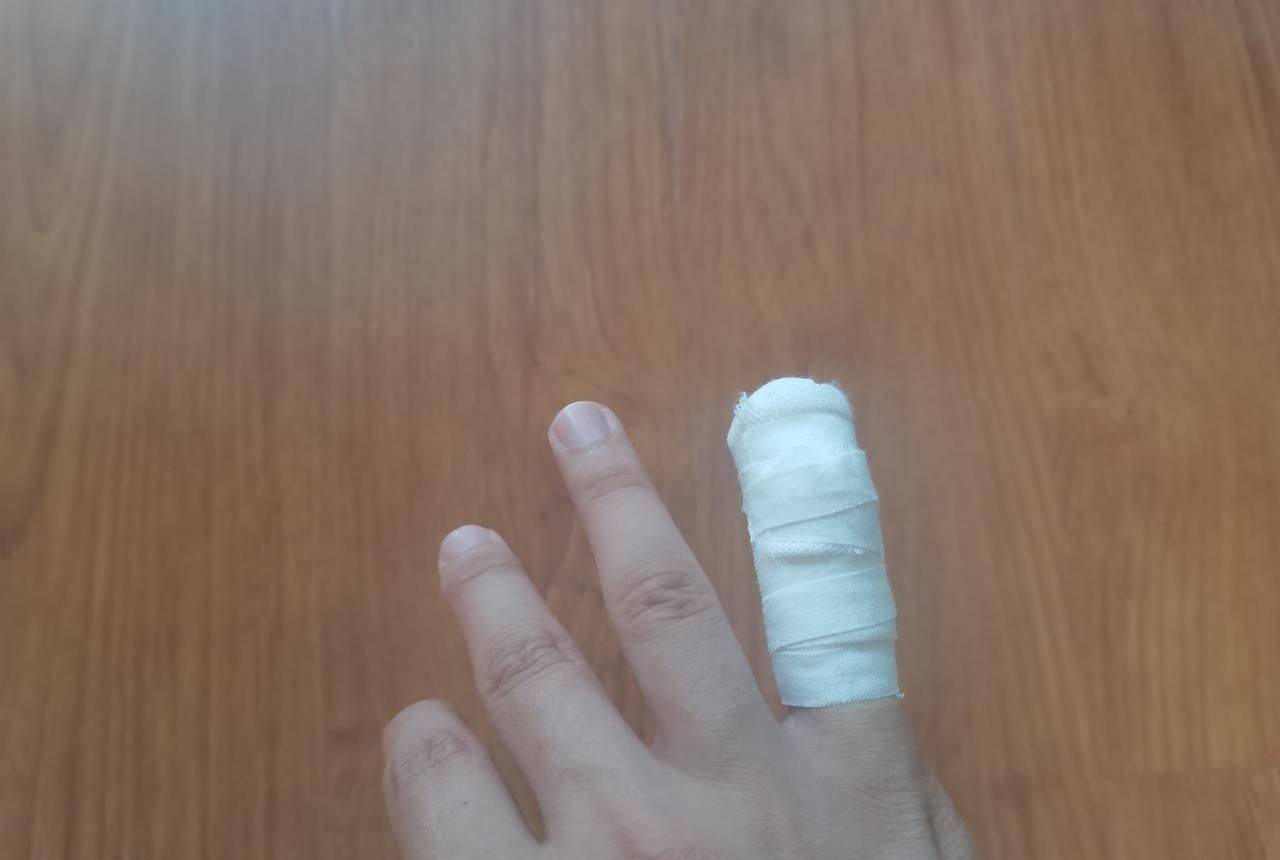 手指骨折后,才发现了君威按键式档位的好处