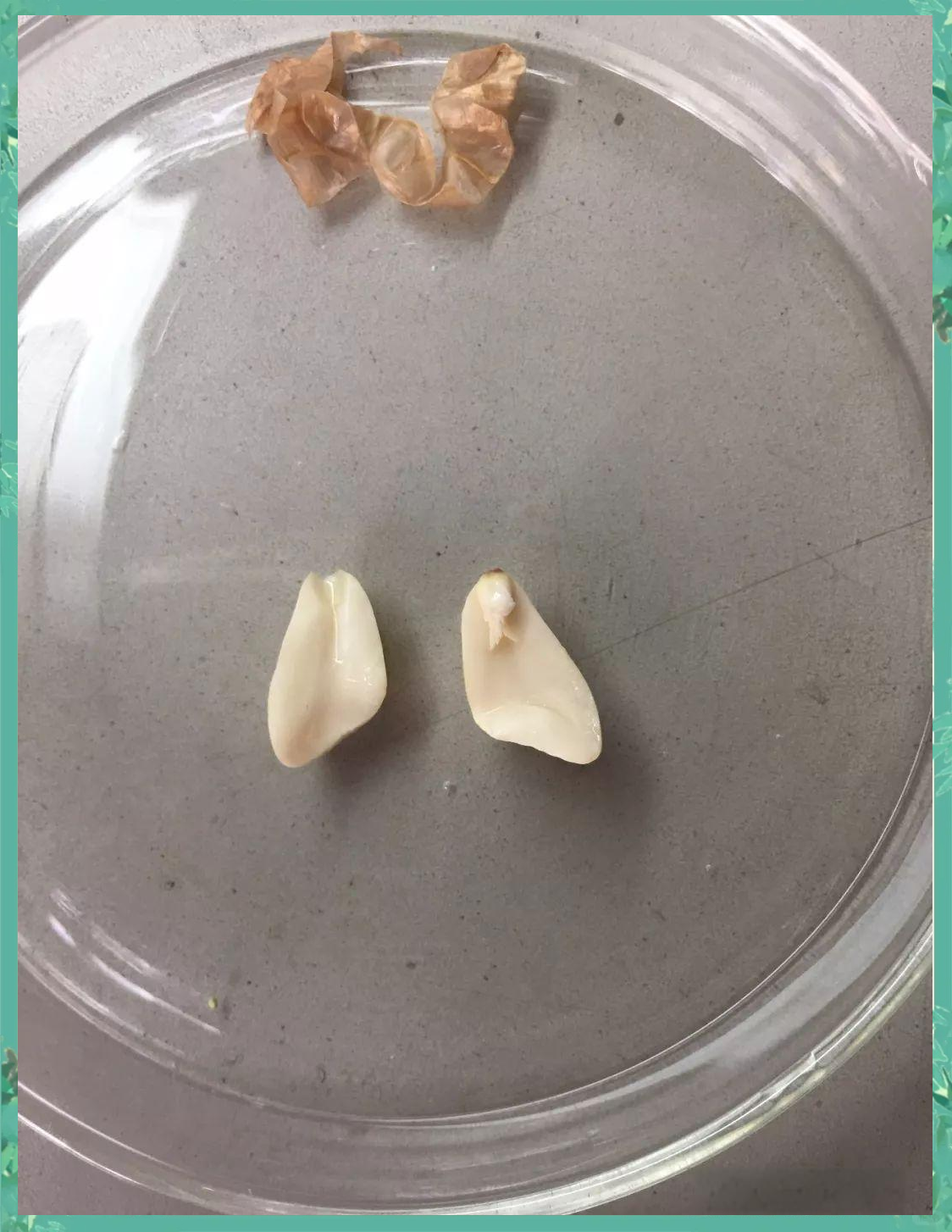 如何绘制双子叶植物种子的基本结构图?