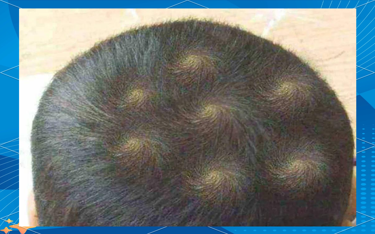 孩子头上的"旋"有何特别之处?家长们需了解的知识