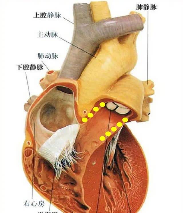 动脉圆锥在哪里?有什么用?