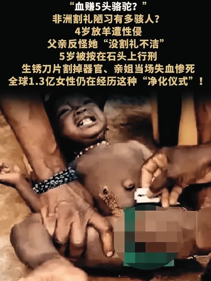 割礼幸存者:那道隐秘的伤疤,真的只能用一生去愈合吗?