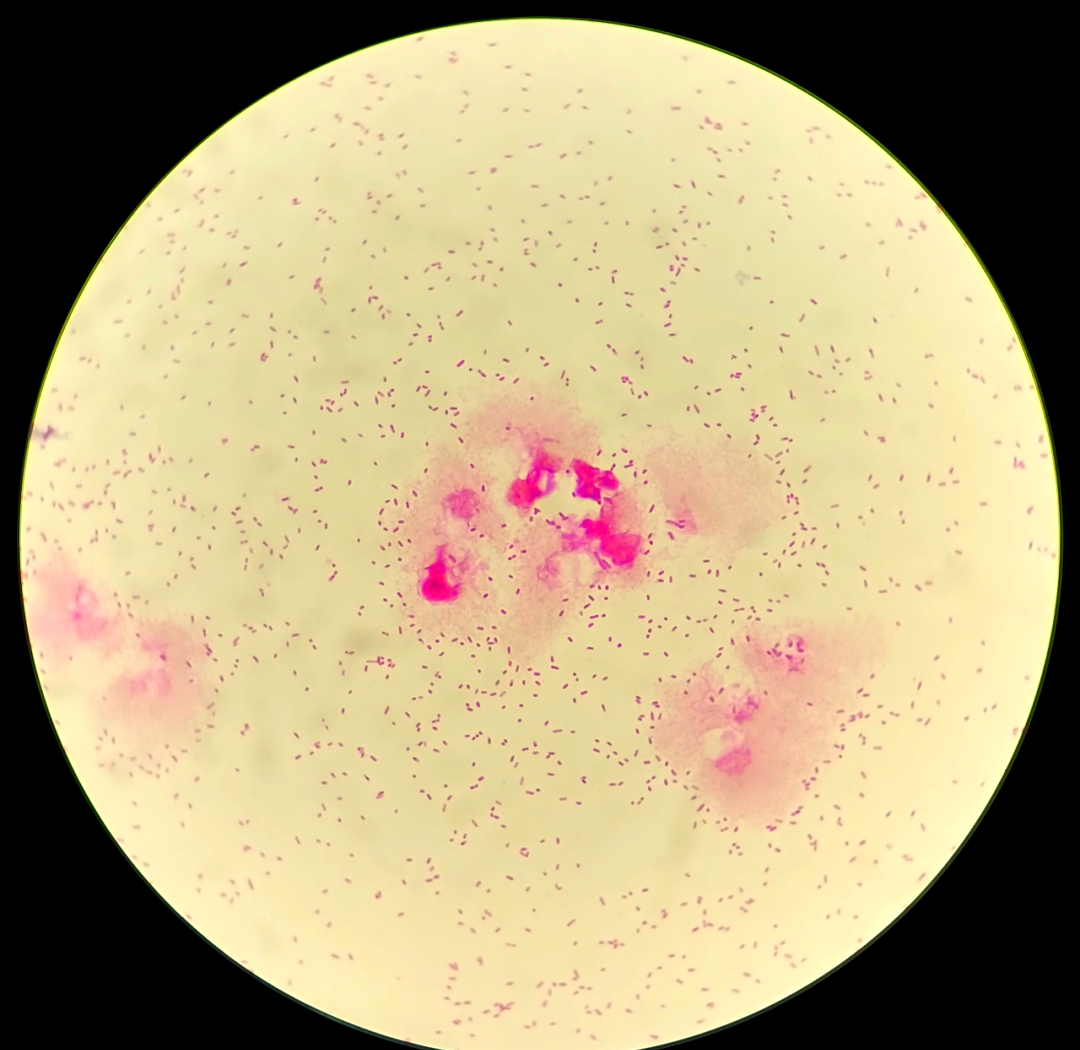 深入探索多种细菌的形态与特征