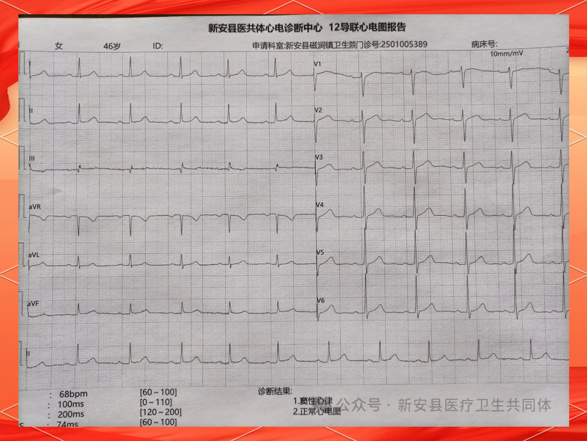 心电图解读:理解心率与心律正常值