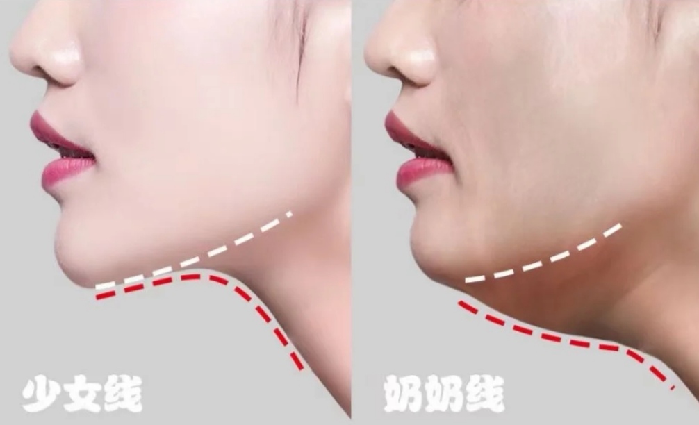 拥有"少女线"的女生,会有这几个明显特征,中两个就很美