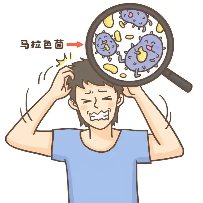 头癣种类多,知己知彼才能百战不殆!