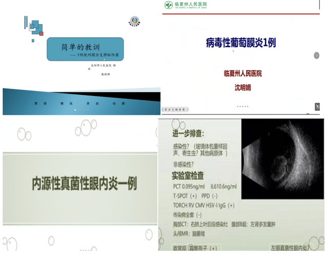 兰大二院"萃英医联"第十二期线上系列活动——眼科专场顺利召开