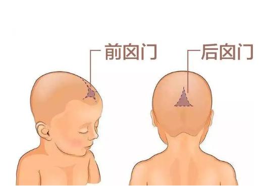 婴儿方颅头型图片图片