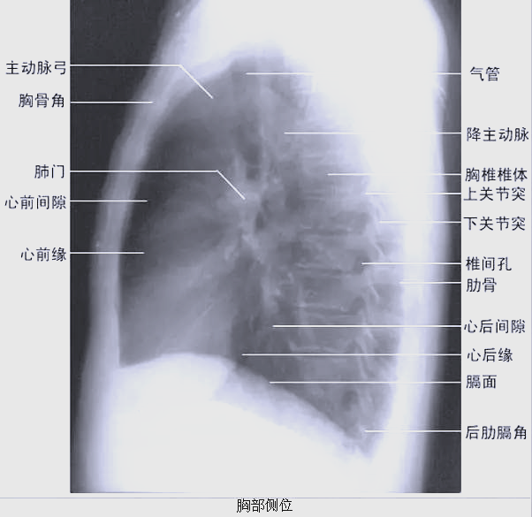 全面解析x线胸片,轻松掌握看片技巧!