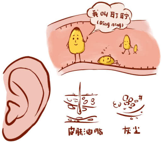 学名为耵聍的耳屎是怎么形成的呢?这里看过来啦