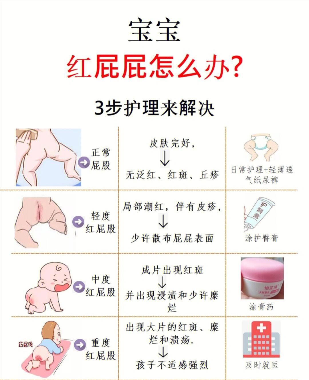 宝宝长尿布疹破皮了怎么办(宝宝长尿布疹怎么护理好)