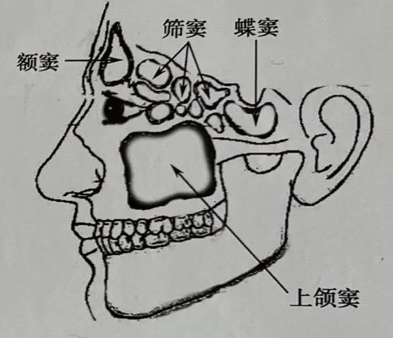 上颌窦的位置图片图片