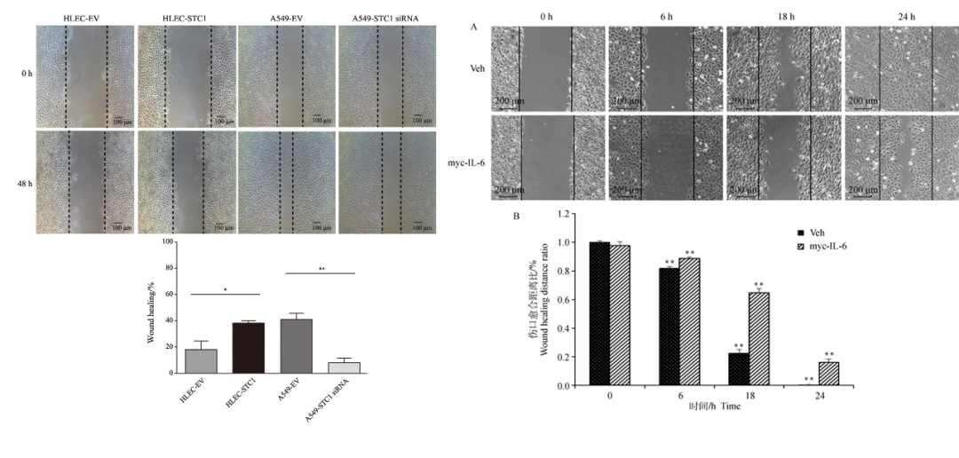 解读文献里的那些图——细胞迁移实验