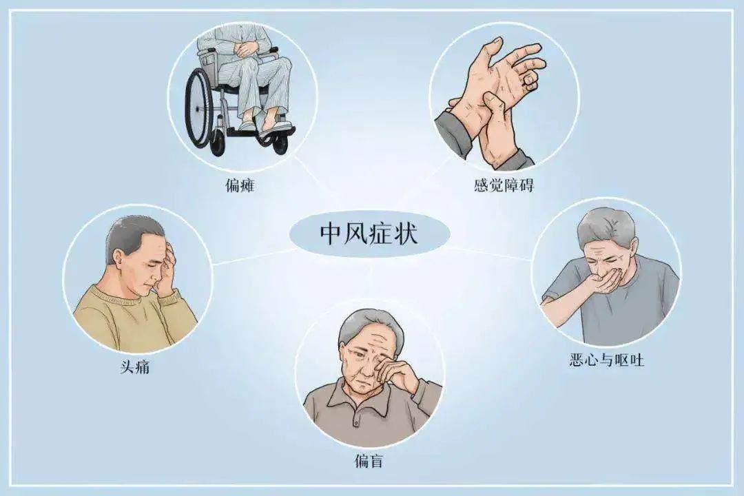脑卒中"盯上"年轻人?出现这些症状要警惕 | 健康总动员