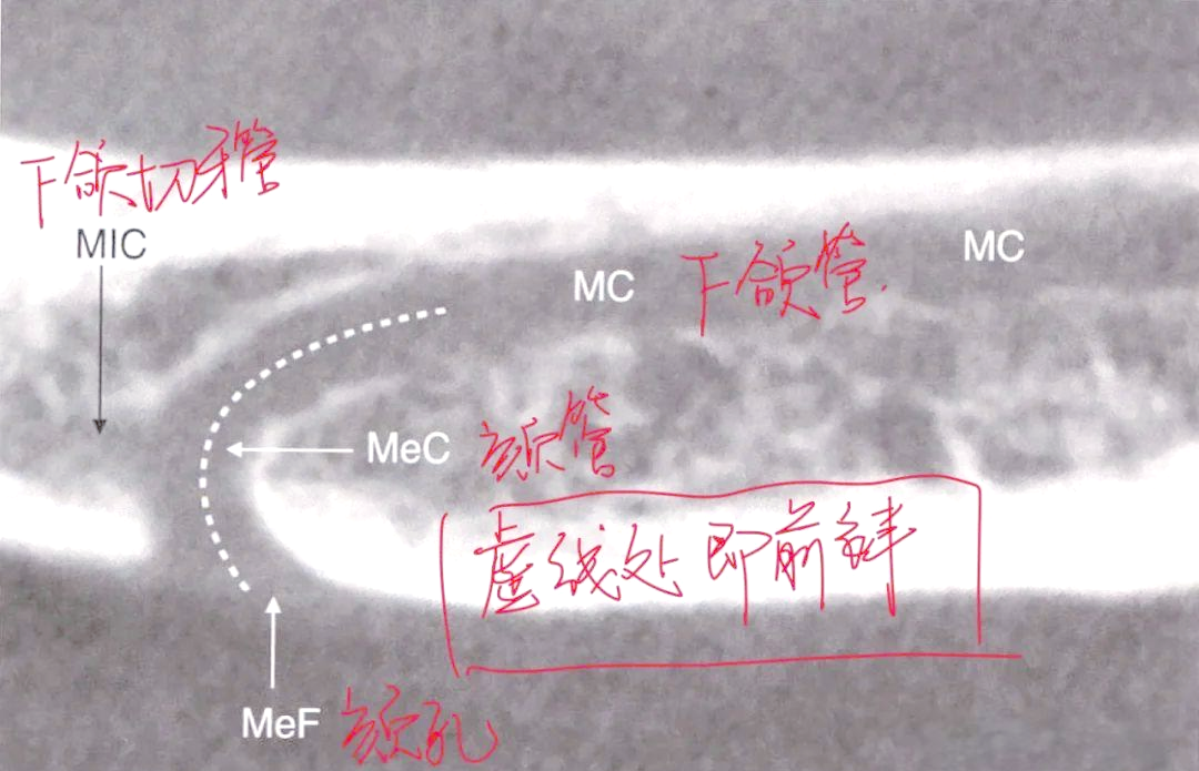 实用口腔解剖-颏孔的详细解析