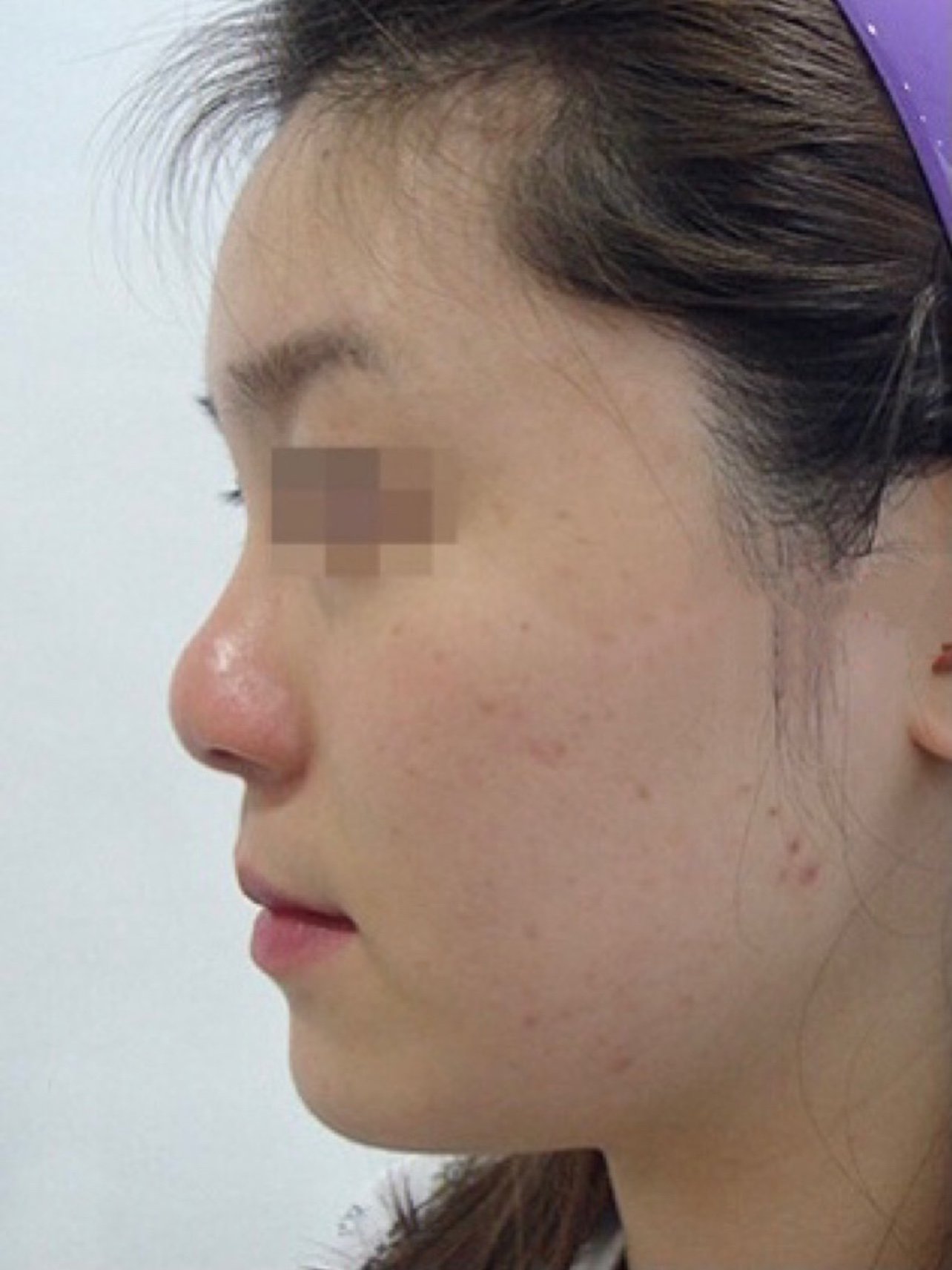 你是哪一类鼻型?