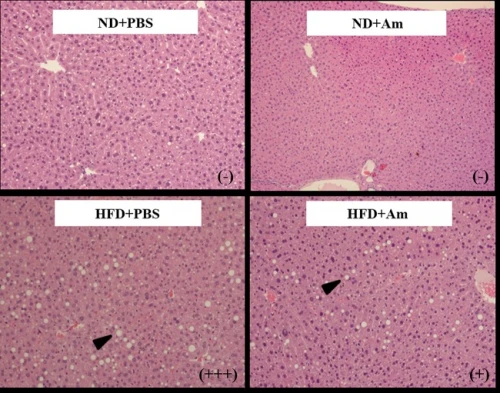 akk菌通过肠道调节或可改善脂肪肝