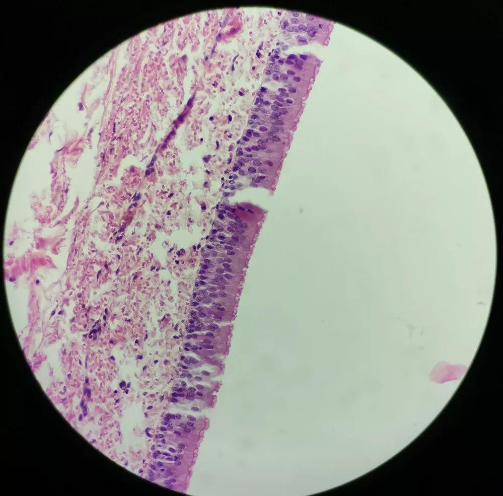 变移上皮,这种上皮组织的特点在于其盖细胞的存在