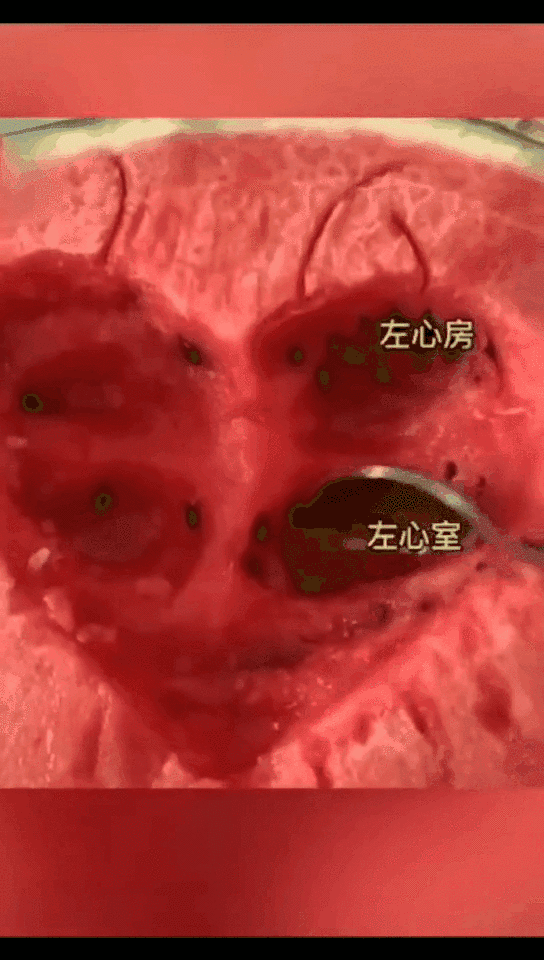 西瓜吃出一个心脏结构,医学生行为能有多可爱