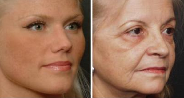 脸部皮肤下垂松弛如何改善