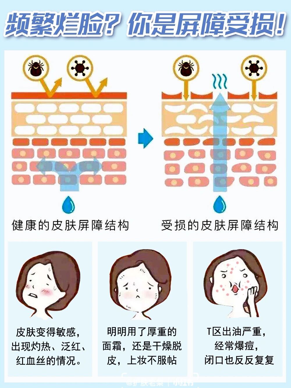 80%的人皮膚屏障受損了,還以為只是普通過敏!