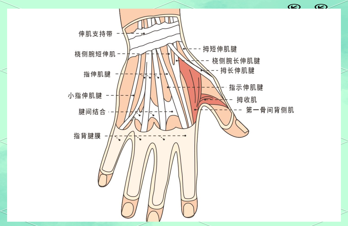 手腕腱鞘炎的成因,治疗方法及预防策略