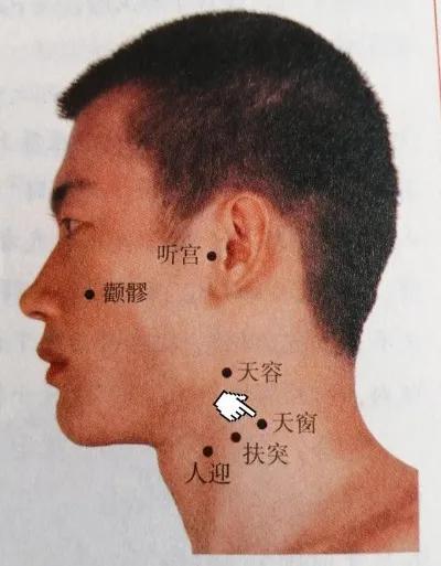 祛风止痛丸的功效图片