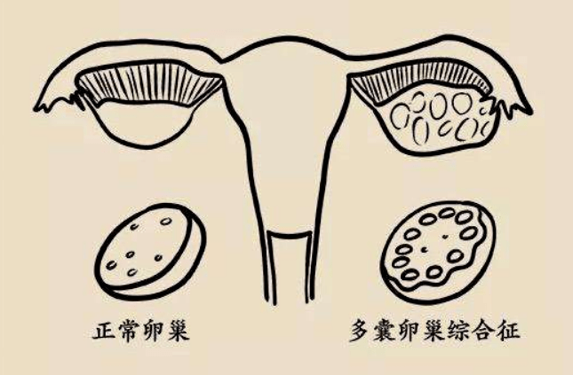 卵泡手绘图图片