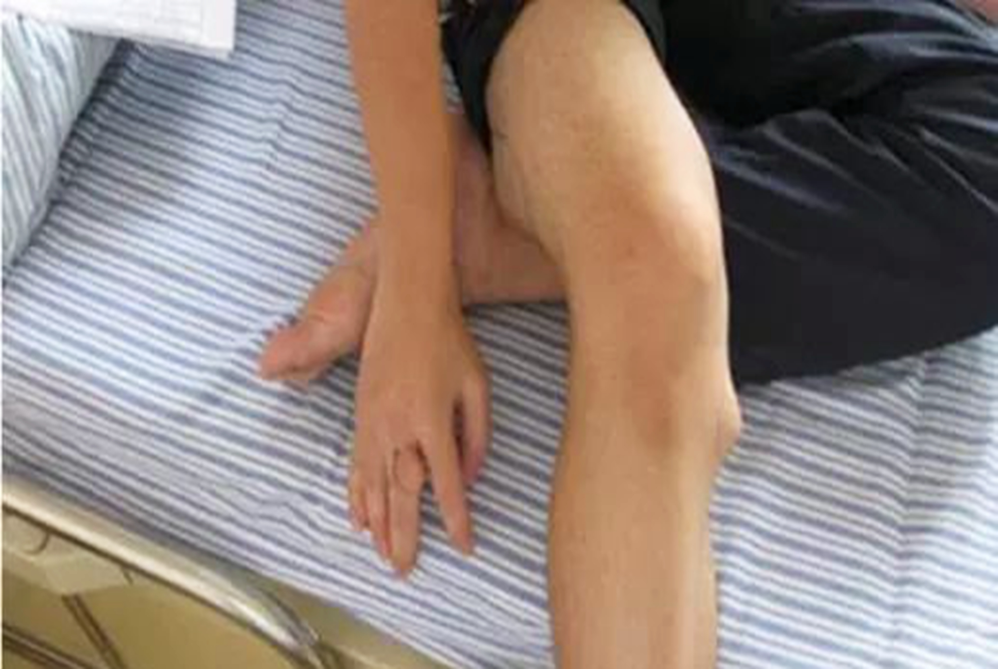 如何正确区分生长痛,孩子出现了这几个信号,是生长痛无疑