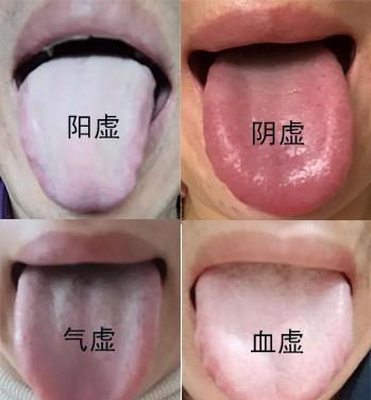 虚证怎么应对呢,来看看阴虚阳虚,气虚血虚怎么应对好 虚分阳虚,阴虚