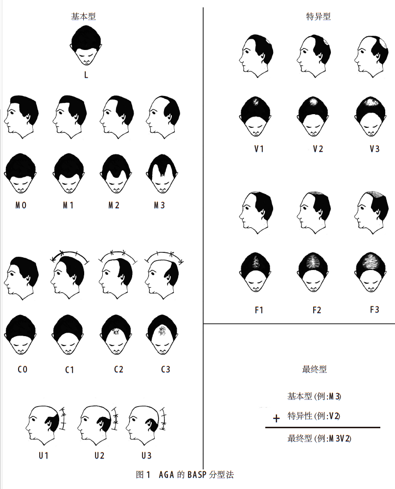 头发分缝的几种分法图片