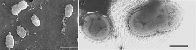 神菌akk,减肥控血糖机制找到了?