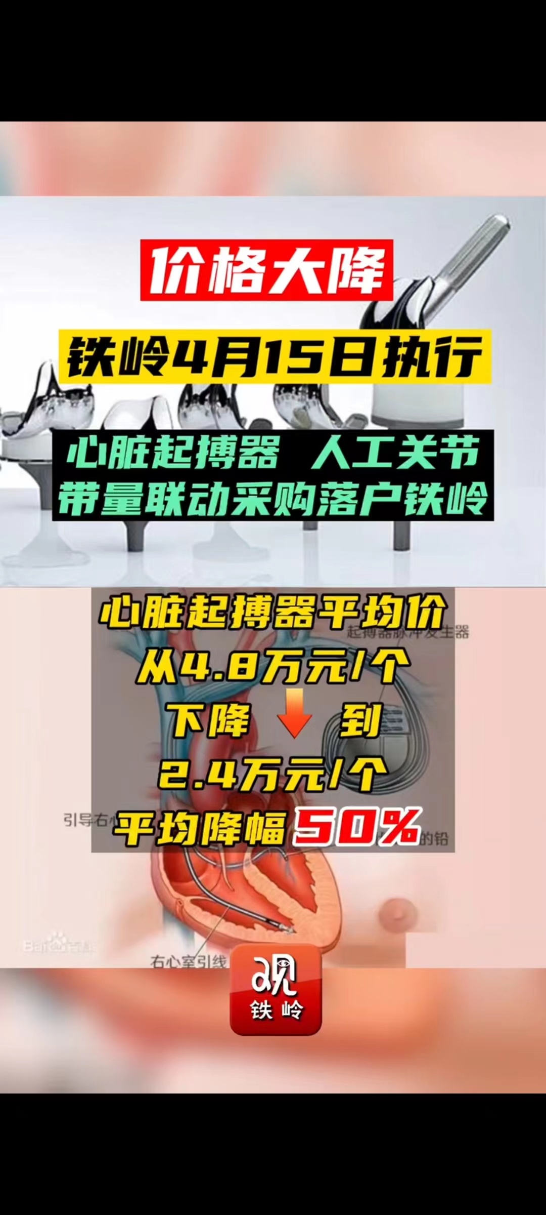 心脏起搏器类与人工关节带量联动采购落户铁岭