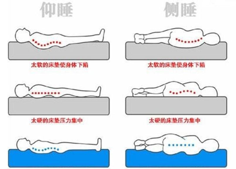 有关颈椎病患者睡觉的那些事