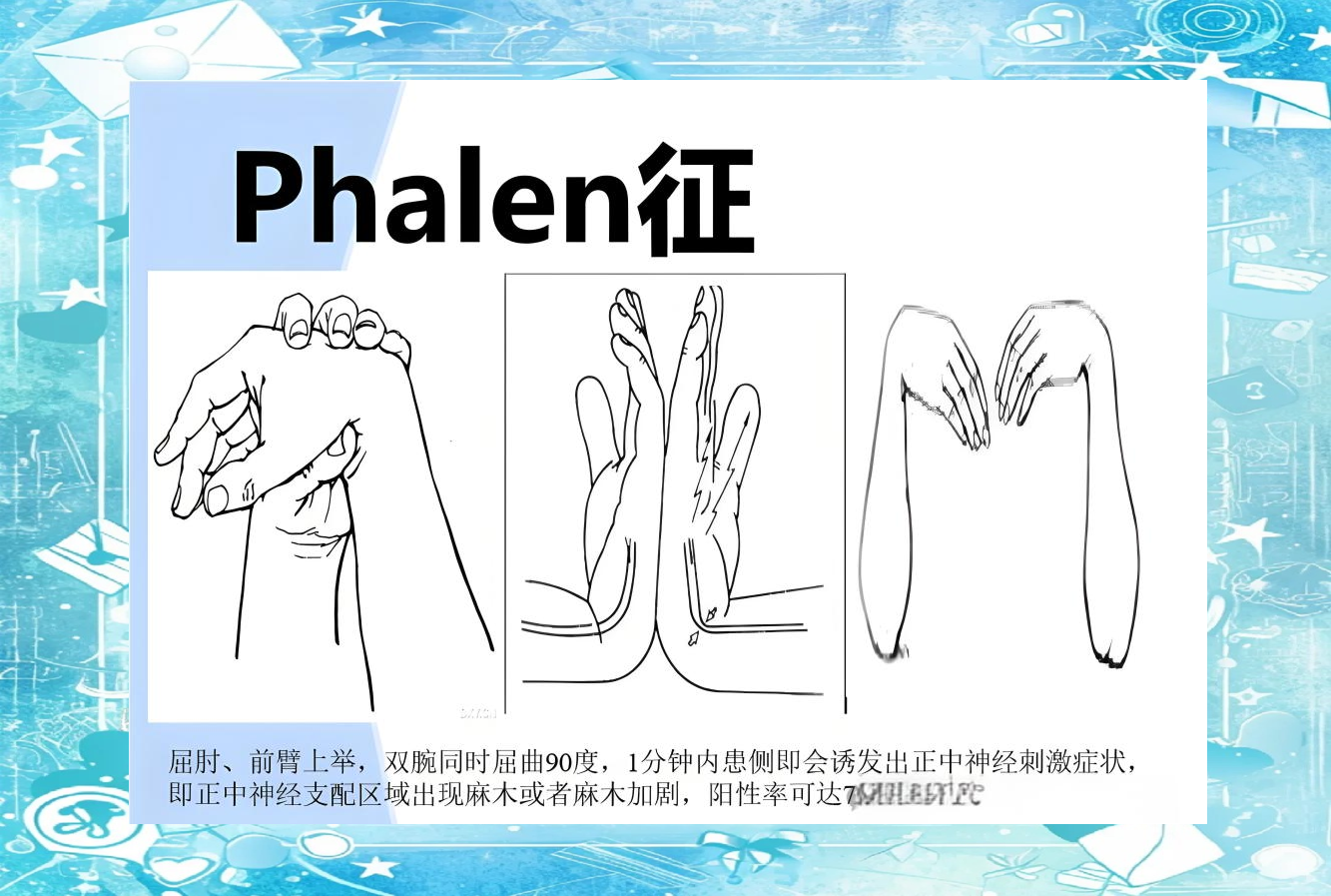 理解旋前圆肌综合征的关键症状与临床评估