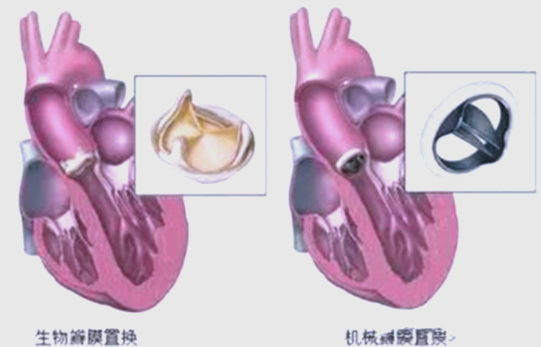 南通胸外科医院：守护健康的重要防线