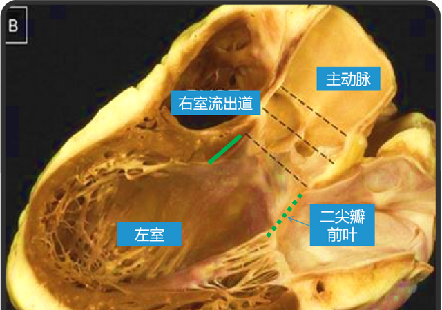 动脉圆锥在哪里?有什么用?