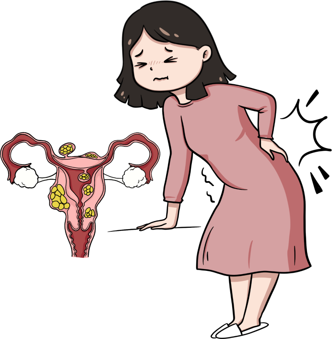 子宫肌瘤,留还是不留?|体检的那些事儿⑤