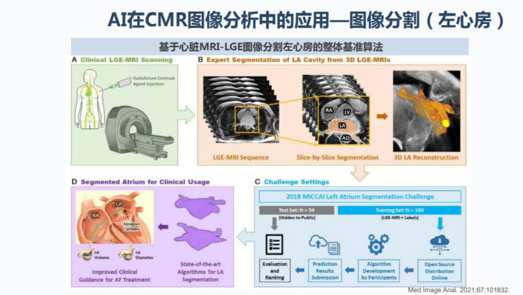 同济医院放射科主任夏黎明:ai在心脏磁共振成像中的研究|附演讲ppt
