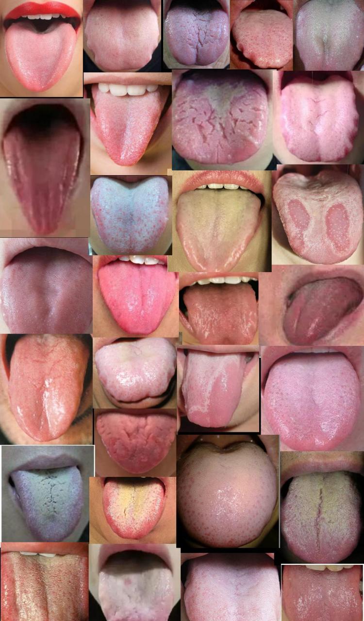 舌头中间有条沟图片