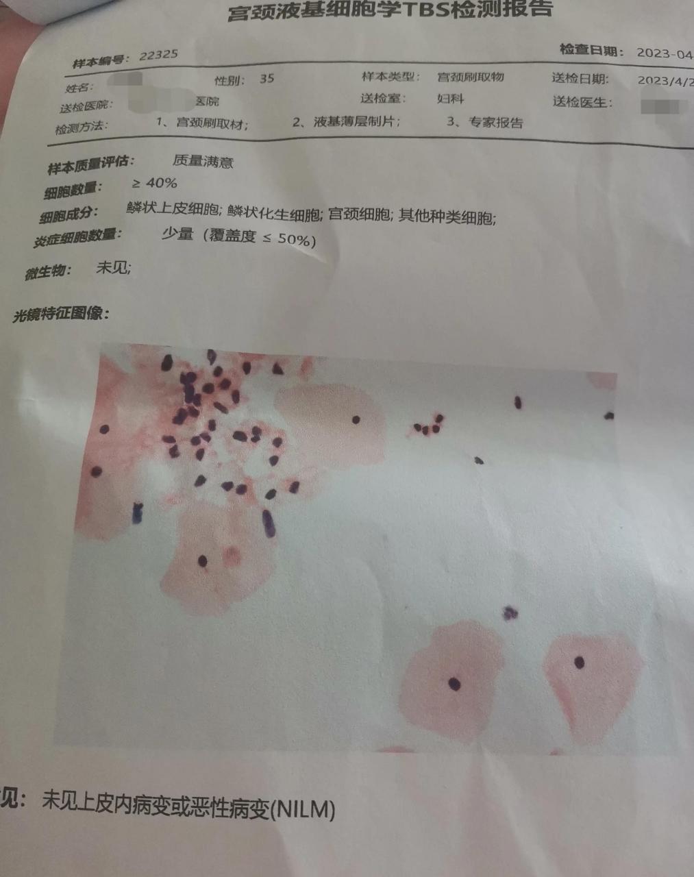 全职宝妈在家带娃,你们后悔吗# 宫颈癌筛查结果出来一个星期了 一直