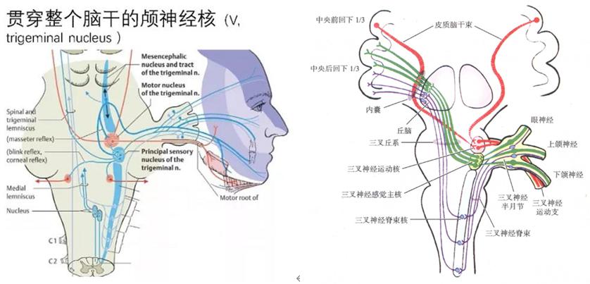 动眼神经交叉瘫——同侧动眼神经麻痹 对侧瘫痪
