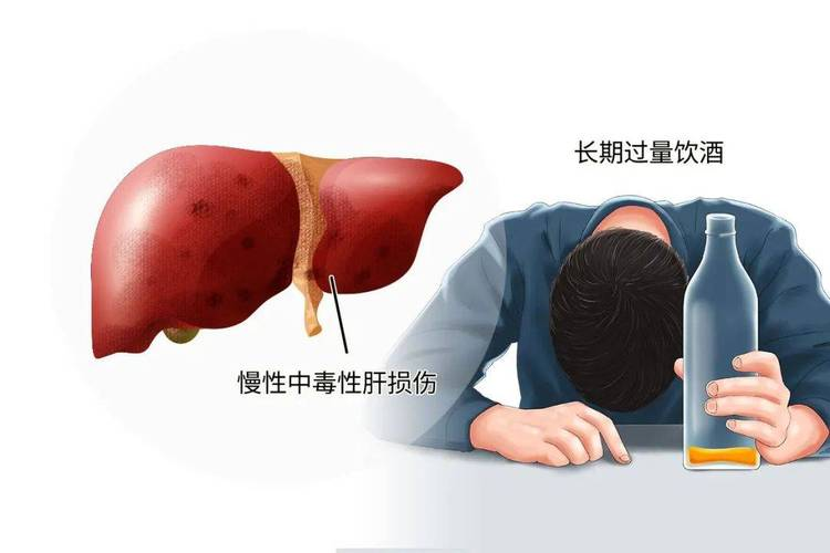 门冬氨酸鸟氨酸颗粒剂在治疗高血氨症中的临床应用与注意事项