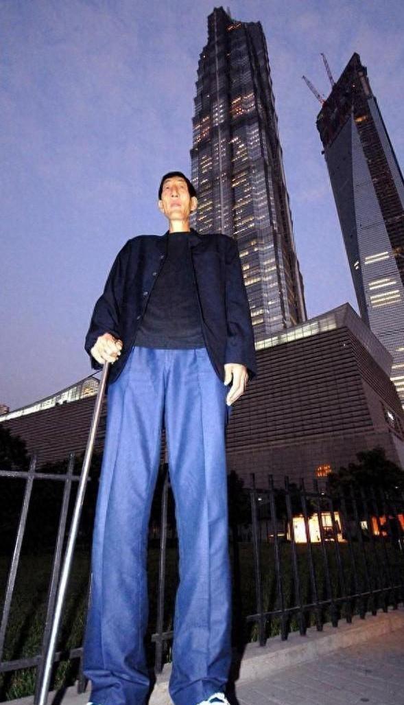 中国巨人鲍喜顺:身高2.36米竟是天生?生长激素检测结果惊呆专家!