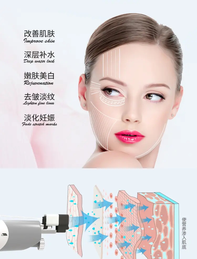 皮肤科医生解读医美项目——黄金射频微针