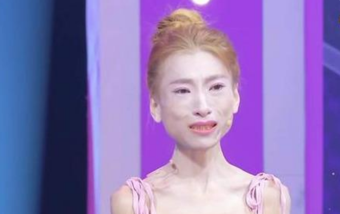 骷髅妹:只因男友一句话瘦到58斤,不料男友早有未婚妻!