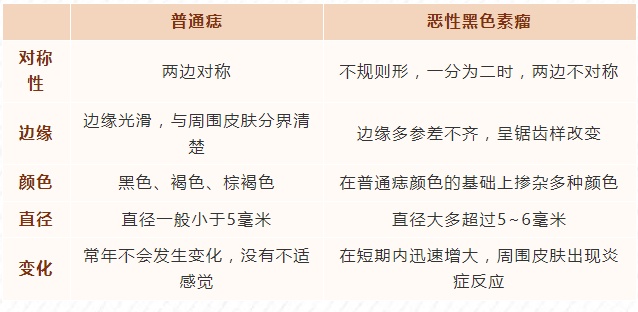 如何区分普通痣与黑色素瘤?5个细节要掌握