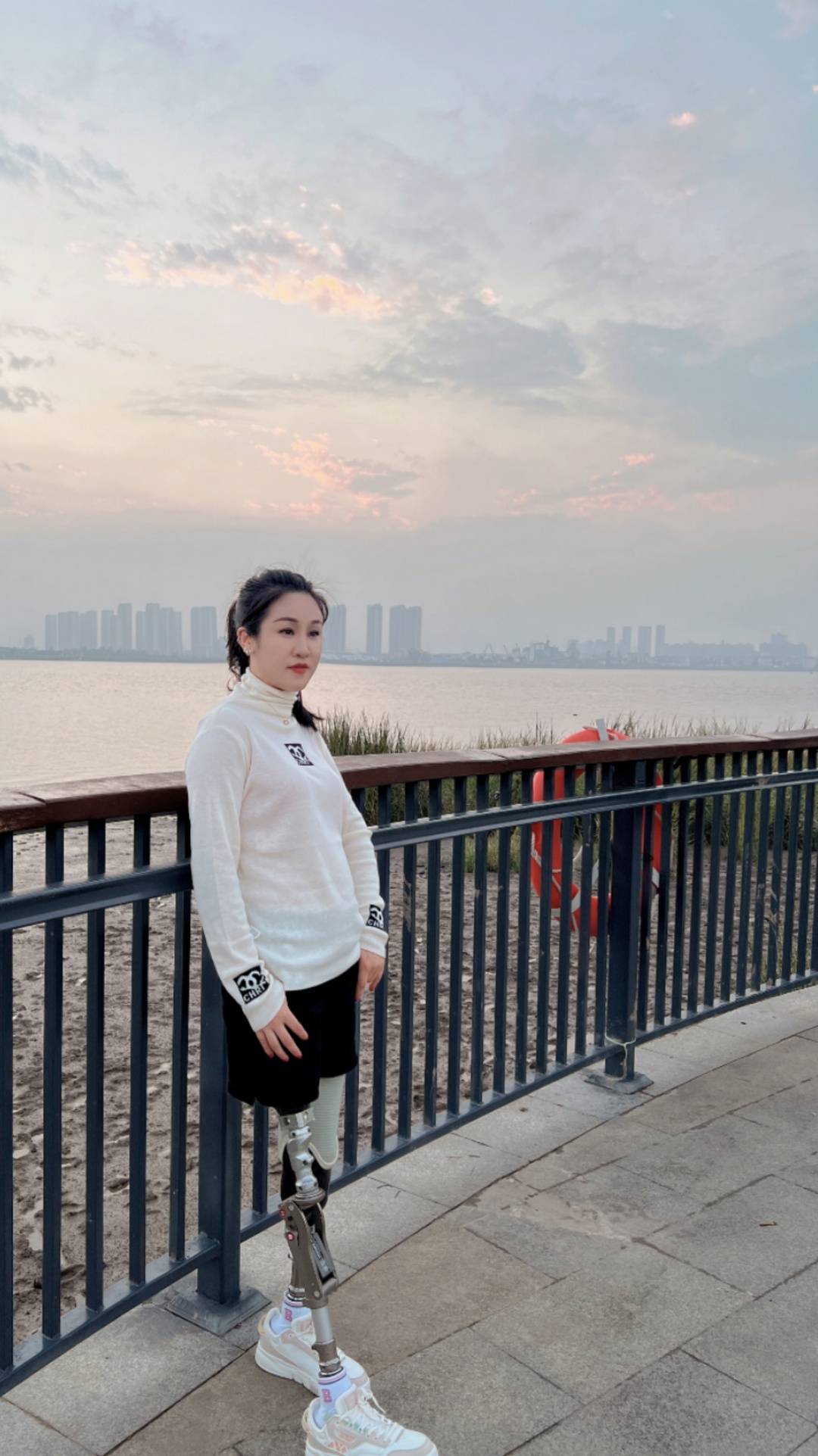 成都都江堰"钢腿歌手"李应霞:登上《中国梦想秀》舞台 未来还想学车考