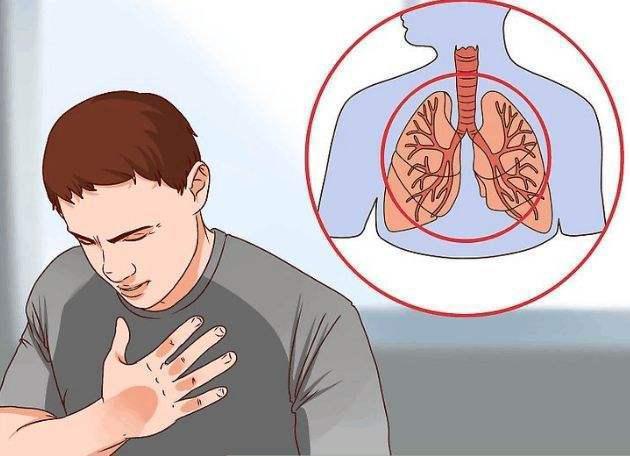 慢阻肺与支气管哮喘,有4个区别