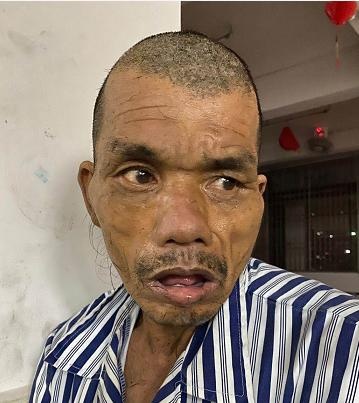 揭阳救助站:中年男子被救助,穿灰色衬衫,神情呆滞