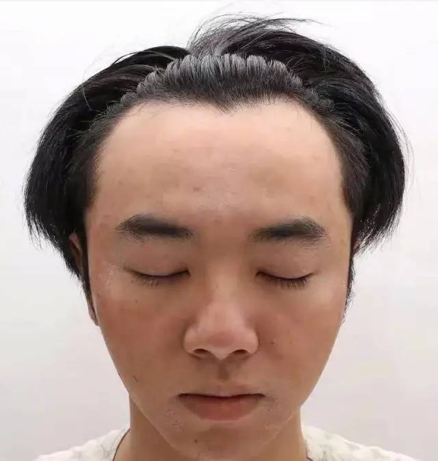 两点锤实华晨宇整容植发!大v呼吁这属于泄露隐私,网友怒其不争